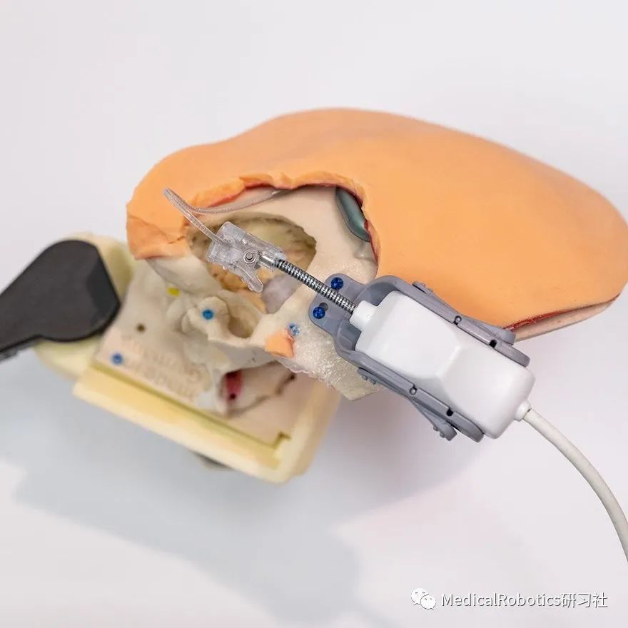 FDA批准了首个人工耳蜗植入机器人